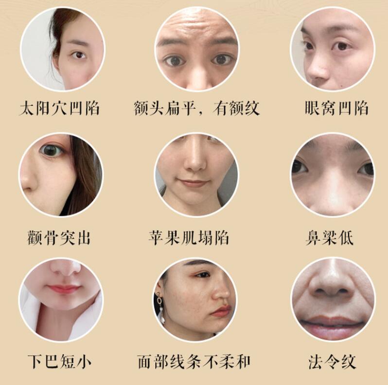 宫廷古方：12节徒手小脸塑颜术-冯宝宝小站
